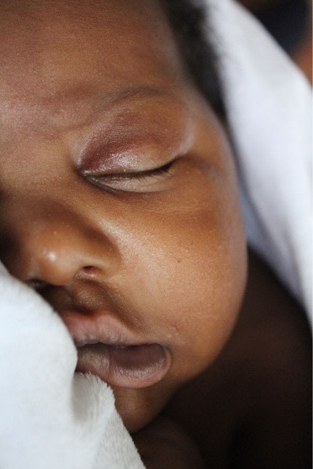Close-Up Photo of Baby's Face // Healthier Baby Today