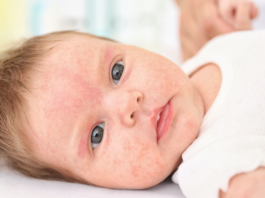 Baby Allergy Medicine: What’s Safe and When to Start // Healthier Baby Today